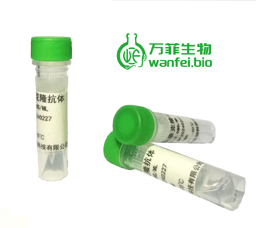 四碘甲状腺原氨酸T4单克隆抗体